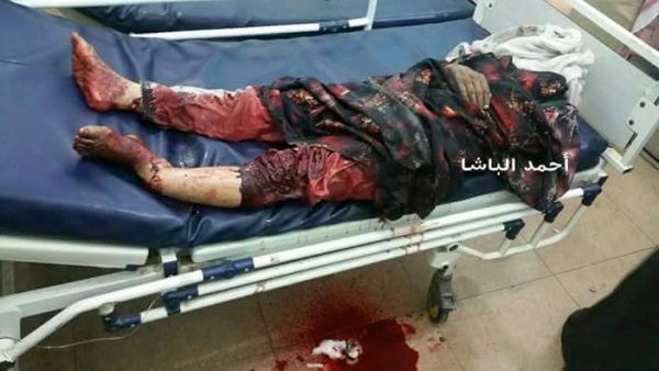 الحكومة اليمنية تطالب المجتمع الدولي بتحمل مسؤولياته تجاه جرائم الإبادة التي ترتكبها الميلشيا الانقلابية بمدينة تعز