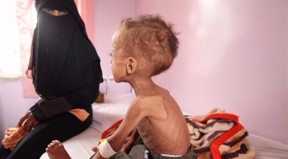 تحصين 269 ألف طفل يمني من الدفتيريا